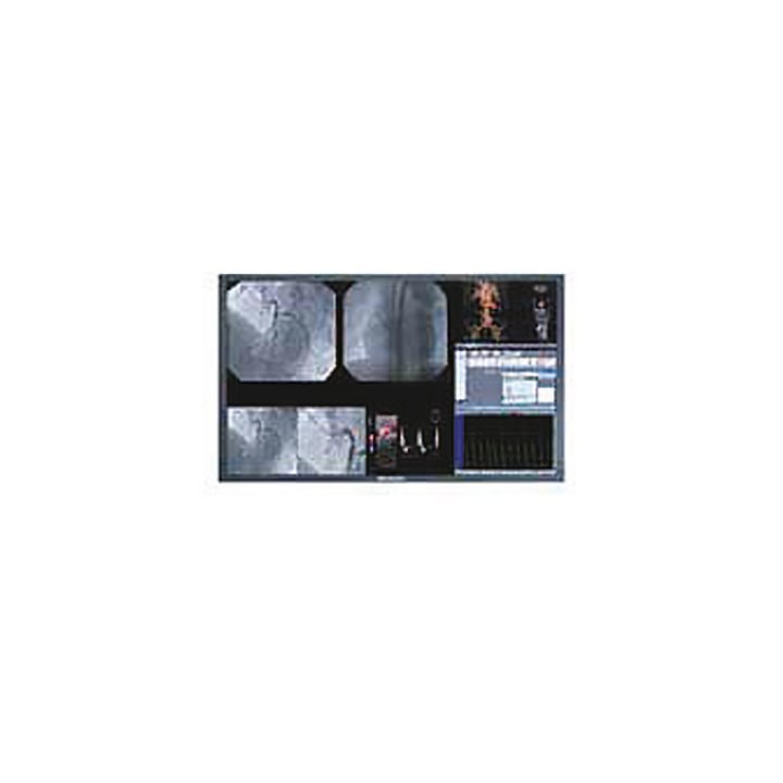 Monitor S551 – Beacon