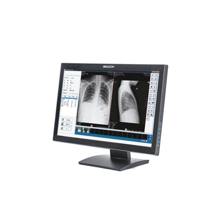 Monitor C22WP – Beacon